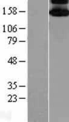 Western Blot: ASK1 Overexpression Lysate (Adult Normal) [NBL1-12856] Left-Empty vector transfected control cell lysate (HEK293 cell lysate); Right -Over-expression Lysate for ASK1.