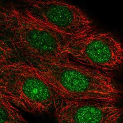 Immunocytochemistry/Immunofluorescence: ASNA1 Antibody [NBP2-14324] - Immunofluorescent staining of human cell line MCF7 shows localization to nucleus & nucleoli.