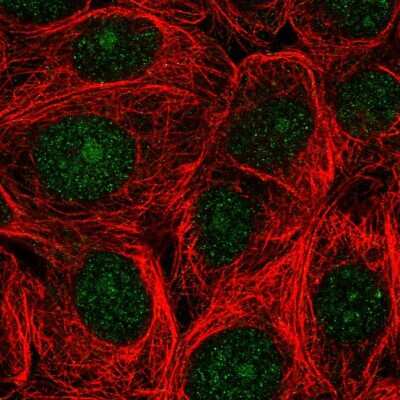 Immunocytochemistry/Immunofluorescence: ASNA1 Antibody [NBP2-56050] - Staining of human cell line MCF7 shows localization to nucleus & nucleoli.