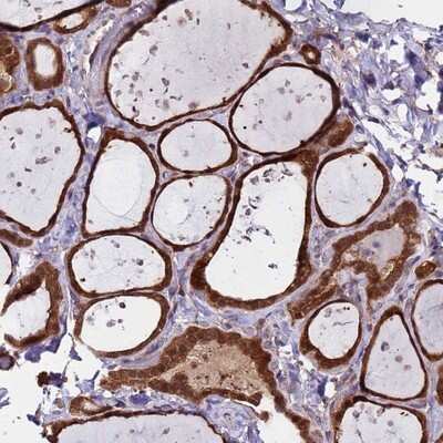 Immunohistochemistry-Paraffin: ASNA1 Antibody [NBP2-14324] - Staining of human thyroid gland shows strong cytoplasmic and nuclear positivity in glandular cells.