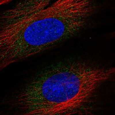 Immunocytochemistry/Immunofluorescence: ASNSD1 Antibody [NBP2-57925] - Staining of human cell line BJ shows localization to cytosol.