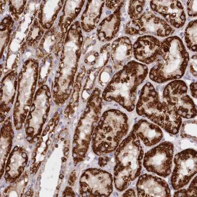 Immunohistochemistry: ASNSD1 Antibody [NBP2-38283] - Staining of human kidney shows strong cytoplasmic positivity with granular pattern in renal tubules.