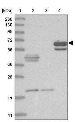 Western Blot: ASNSD1 Antibody [NBP1-83634] - Lane 1: Marker  [kDa] 230, 130, 95, 72, 56, 36, 28, 17, 11.  Lane 2: Human cell line RT-4.  Lane 3: Human cell line U-251MG sp.  Lane 4: Human plasma (IgG/HSA depleted)