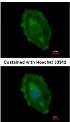 Immunocytochemistry/Immunofluorescence: ASPA Antibody [NBP2-15491] - Analysis of paraformaldehyde-fixed HeLa, using antibody at 1:500 dilution.