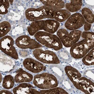 Immunohistochemistry-Paraffin: ASPA Antibody [NBP1-89258] - Staining of human kidney shows strong cytoplasmic positivity in cells in tubules.