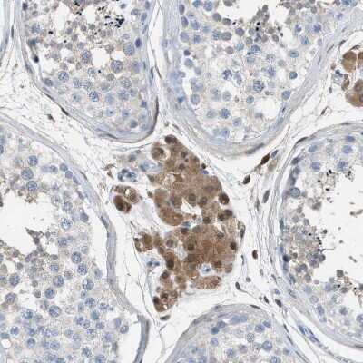 Immunohistochemistry-Paraffin: ASPA Antibody [NBP1-89258] - Staining of human testis shows moderate cytoplasmic positivity in Leydig cells.