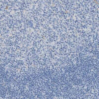 Immunohistochemistry-Paraffin: ASPA Antibody [NBP1-89258] - Staining of human tonsil shows no positivity in germinal center cells as expected.