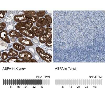 Immunohistochemistry-Paraffin: ASPA Antibody [NBP1-89258] - Analysis in human kidney and tonsil tissues using NBP1-89258 antibody. Corresponding ASPA RNA-seq data are presented for the same tissues.