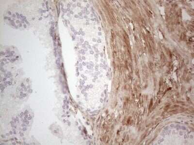 Immunohistochemistry: ASPA Antibody (OTI3G5) - Azide and BSA Free [NBP2-70216] - Analysis of Human prostate tissue. (Heat-induced epitope retrieval by 1mM EDTA in 10mM Tris buffer (pH8.5) at 120C for 3 min)(1:150)