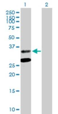 Western Blot: ASPA Antibody [H00000443-B01P] - Analysis of ASPA expression in transfected 293T cell line by ASPA polyclonal antibody.  Lane 1: ASPA transfected lysate(34.43 KDa). Lane 2: Non-transfected lysate.