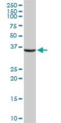 Western Blot: ASPA Antibody [H00000443-D01P] - Analysis of ASPA expression in human liver.