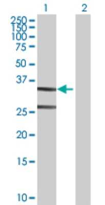 Western Blot: ASPA Antibody [H00000443-D01P] - Analysis of ASPA expression in transfected 293T cell line by ASPA polyclonal antibody.Lane 1: ASPA transfected lysate(35.70 KDa).Lane 2: Non-transfected lysate.