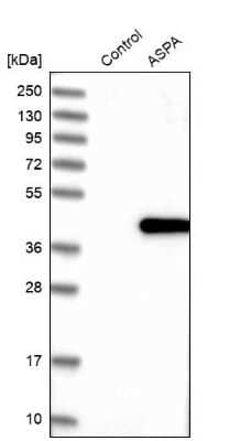 Western Blot: ASPA Antibody [NBP1-89258] - Analysis in control (vector only transfected HEK293T lysate) and ASPA over-expression lysate (Co-expressed with a C-terminal myc-DDK tag (3.1 kDa) in mammalian HEK293T cells).