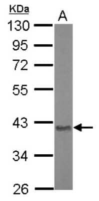 Western Blot: ASPA Antibody [NBP2-15491] - Sample (20 ug of whole cell lysate) A: Mouse brain 10% SDS PAGE gel, diluted at 1:10000.