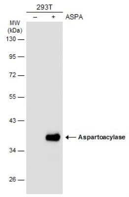 Western Blot: ASPA Antibody [NBP2-15491] - Non-transfected (-) and transfected (+) 293T whole cell extracts (30 ug) were separated by 10% SDS-PAGE, and the membrane was blotted with ASPA antibody diluted at 1:10000.