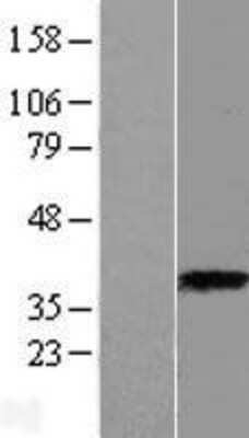 Western Blot: ASPA Overexpression Lysate (Adult Normal) [NBL1-07772] Left-Empty vector transfected control cell lysate (HEK293 cell lysate); Right -Over-expression Lysate for ASPA.