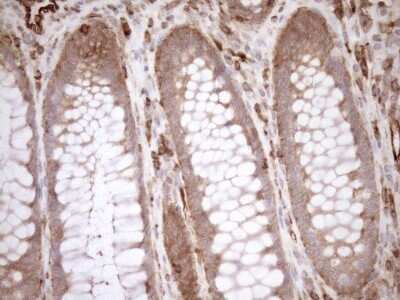 Immunohistochemistry ASPDH Antibody (OTI4G8)