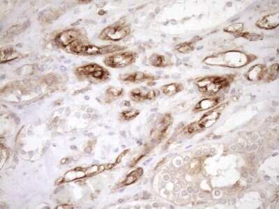 Immunohistochemistry ASPDH Antibody (OTI4G8)