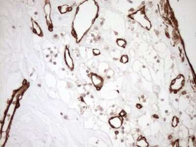 Immunohistochemistry ASPDH Antibody (OTI4G8)