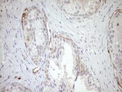 Immunohistochemistry ASPDH Antibody (OTI4G8)