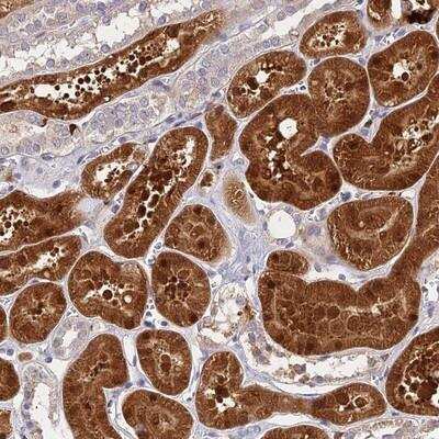 Immunohistochemistry: ASPDH Antibody [NBP1-86213] - Staining of human kidney shows strong cytoplasmic and nuclear positivity in renal tubules.