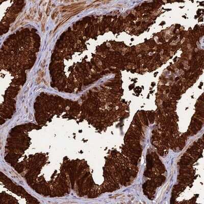 Immunohistochemistry-Paraffin ASPDH Antibody - BSA Free