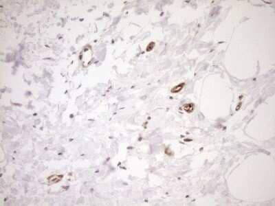 Immunohistochemistry ASPDH Antibody (OTI4G8) - Azide and BSA Free