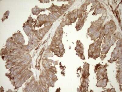 Immunohistochemistry ASPDH Antibody (OTI4G8) - Azide and BSA Free