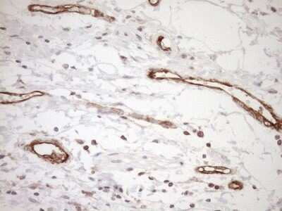 Immunohistochemistry ASPDH Antibody (OTI4G8) - Azide and BSA Free