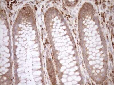 Immunohistochemistry ASPDH Antibody (OTI4G8) - Azide and BSA Free