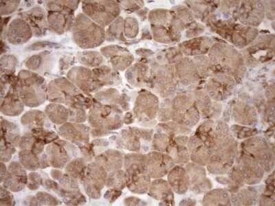 Immunohistochemistry ASPDH Antibody (OTI4G8) - Azide and BSA Free