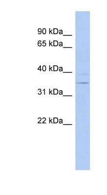 Western Blot: ASPDH Antibody [NBP1-56824] - Human Spleen lysate, concentration 0.2-1 ug/ml.