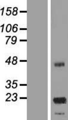 Western Blot ASPDH Overexpression Lysate