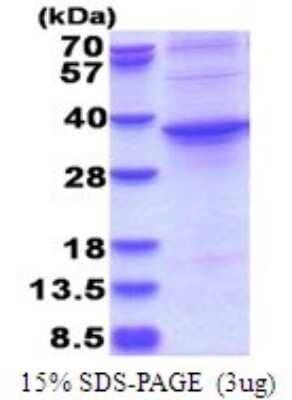 SDS-PAGE Recombinant Human ASPHD1 His Protein