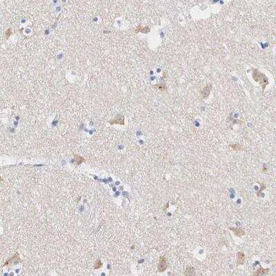 Immunohistochemistry-Paraffin: ASPHD2 Antibody [NBP1-83461] - Staining of human lateral ventricle shows cytoplasmic positivity in neuronal cells.