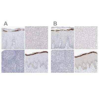 <b>Independent Antibodies Validation and Orthogonal Strategies Validation.</b>Immunohistochemistry-Paraffin: ASPRV1 Antibody [NBP1-83570] - Staining of human cervix, uterine, liver, lymphoid tissues and skin using Anti-ASPRV1 antibody NBP1-83570 (A) shows similar protein distribution across tissues to independent antibody NBP2-33981 (B).