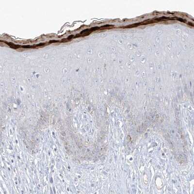 Immunohistochemistry-Paraffin: ASPRV1 Antibody [NBP1-83570] - Staining of human skin shows strong cytoplasmic positivity in keratinocytes.