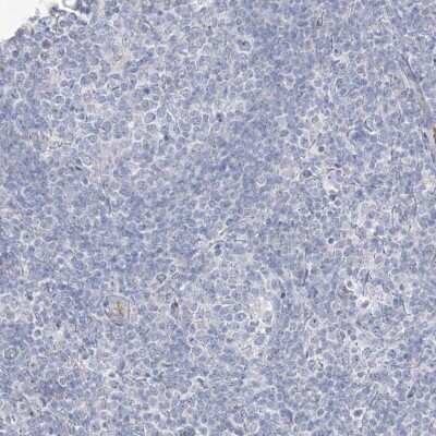 Immunohistochemistry-Paraffin: ASPRV1 Antibody [NBP1-83570] - Staining of human tonsil shows no positivity in non-germinal center cells as expected.