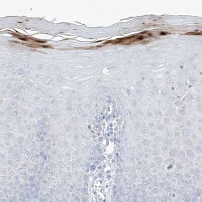 Immunohistochemistry-Paraffin: ASPRV1 Antibody [NBP1-83570] - Staining of human uterine cervix shows moderate to strong cytoplasmic positivity in keratinocytes.