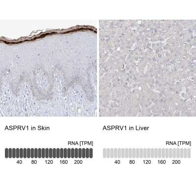 Immunohistochemistry-Paraffin: ASPRV1 Antibody [NBP1-83570] - Staining in human skin and liver tissues using NBP1-83570 antibody. Corresponding ASPRV1 RNA-seq data are presented for the same tissues.