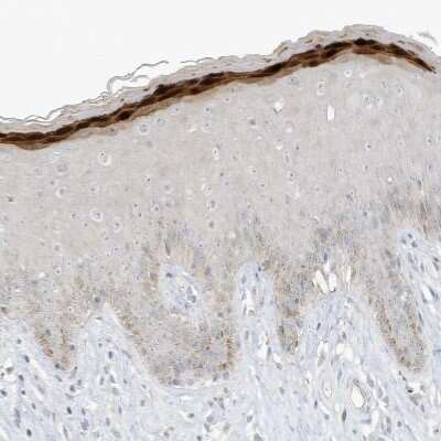 Immunohistochemistry-Paraffin: ASPRV1 Antibody [NBP2-33981] - Staining of human skin shows strong cytoplasmic positivity in keratinocytes.