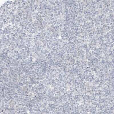 Immunohistochemistry-Paraffin: ASPRV1 Antibody [NBP2-33981] - Staining of human tonsil shows no positivity in non-germinal center cells as expected.