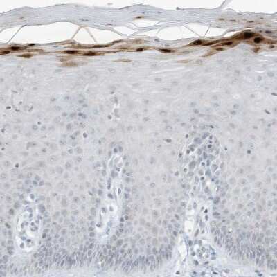 Immunohistochemistry-Paraffin: ASPRV1 Antibody [NBP2-33981] - Staining of human uterine cervix shows moderate to strong cytoplasmic positivity in keratinocytes.