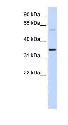 Western Blot: ASPRV1 Antibody [NBP1-56511] - Human Lung lysate, concentration 0.2-1 ug/ml.