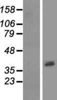 Western Blot: ASPRV1 Overexpression Lysate (Adult Normal) [NBL1-07775] Left-Empty vector transfected control cell lysate (HEK293 cell lysate); Right -Over-expression Lysate for ASPRV1.