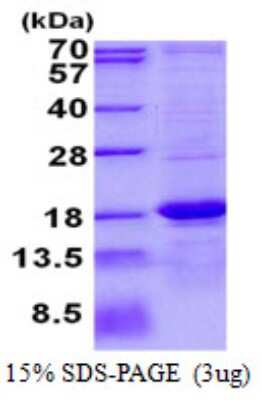 SDS-Page: ASPRV1 Protein [NBP2-22698]