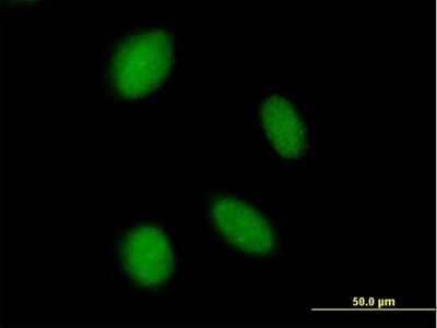 Immunocytochemistry/ Immunofluorescence ASXL2 Antibody