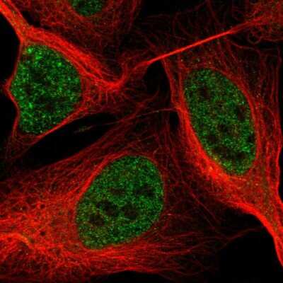 Immunocytochemistry/ Immunofluorescence ASXL2 Antibody - BSA Free