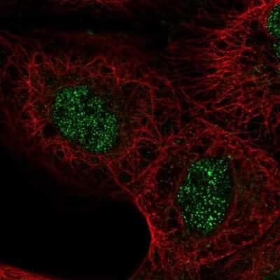 Immunocytochemistry/Immunofluorescence: ASXL2 Antibody [NBP2-58342] - Staining of human cell line A-431 shows localization to nucleoplasm.
