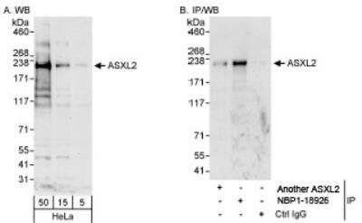 Western Blot ASXL2 Antibody - BSA Free